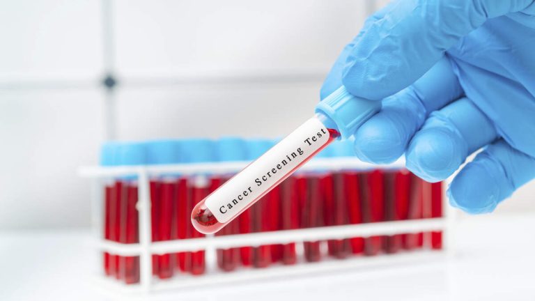 FDA Approves New Blood Test To Screen For Colon Cancer