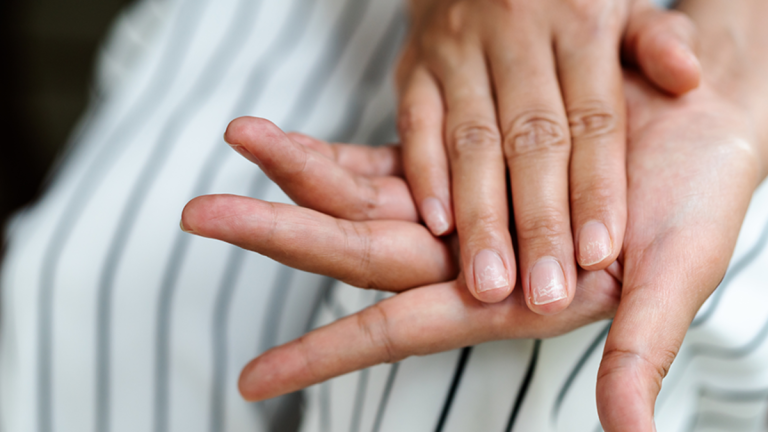 If You See This On Your Nails, See A Doctor Now