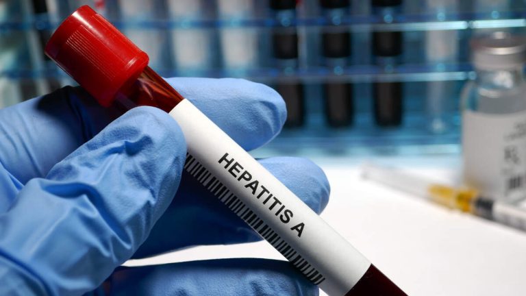 Hepatitis A Outbreak Declared in Los Angeles County
