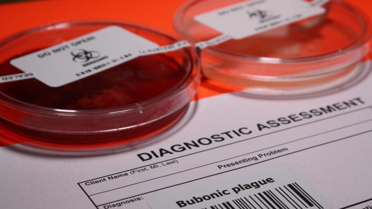 Patient Dies In Emergency Room From The Bubonic Plague