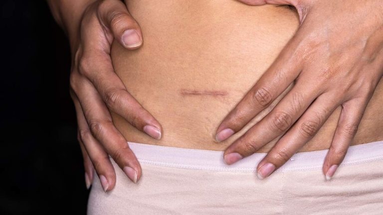 Entire Town’s Residents All Need To Have Their Appendixes Removed