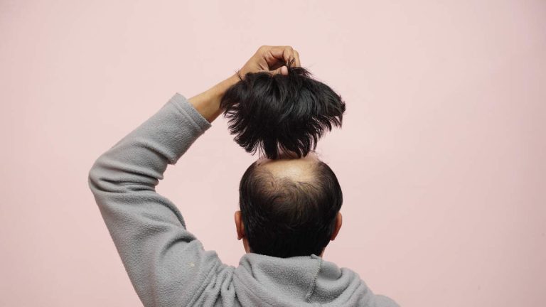 Video Shows Airport Security Uncover Cocaine Hidden Under Man’s Toupee