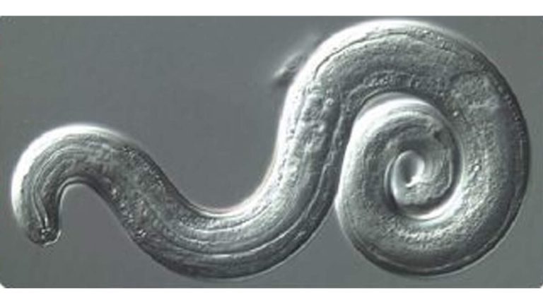 Woman Infected By Brain Worms During Hawaiian Vacation