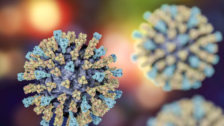 Unvaccinated Adult Tested Positive For Measles After Death