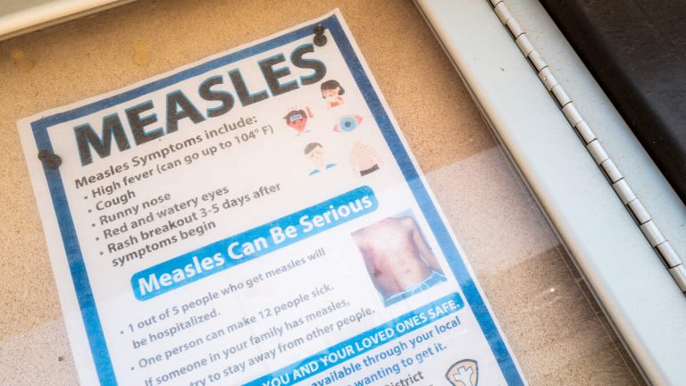 US Reports Highest Number Of Measles Cases Since 2019