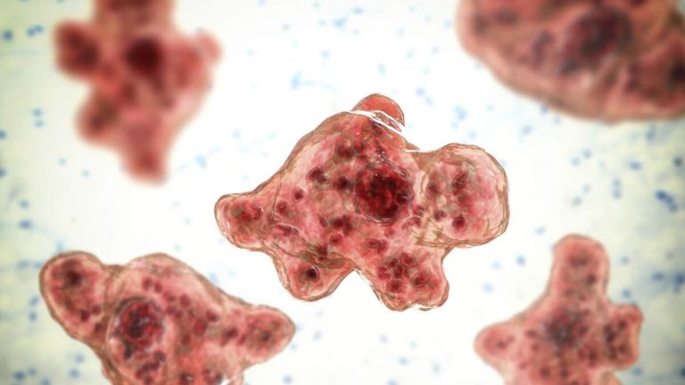 Brain-Eating Amoeba Kills Woman Who Used Tap Water In Nasal Rinse Device