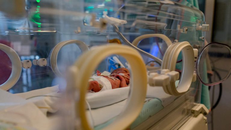 World’s Most Premature Baby Miraculously Reaches 1st Birthday
