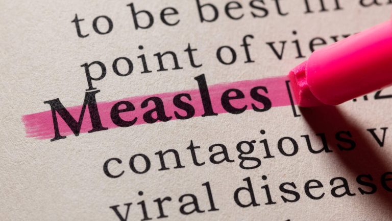 Orange County Toddler Diagnosed with Measles