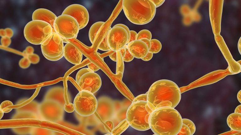 Deadly Drug-Resistant Superbug Spreading Across US