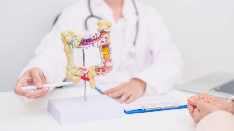 Rise In Colon Cancer Deaths Among Young People Concerns Doctors