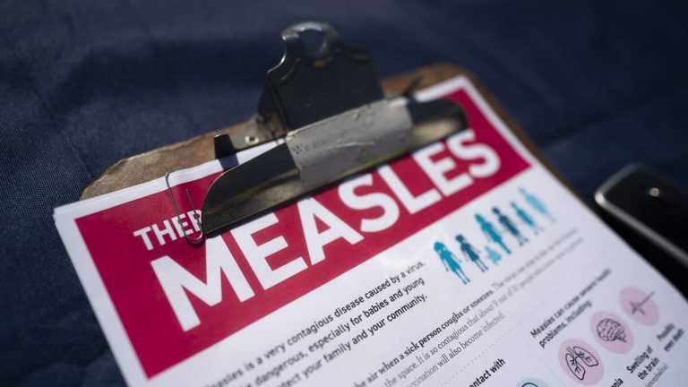 US Has Surpassed 1,100 Measles Cases In Just Two Months