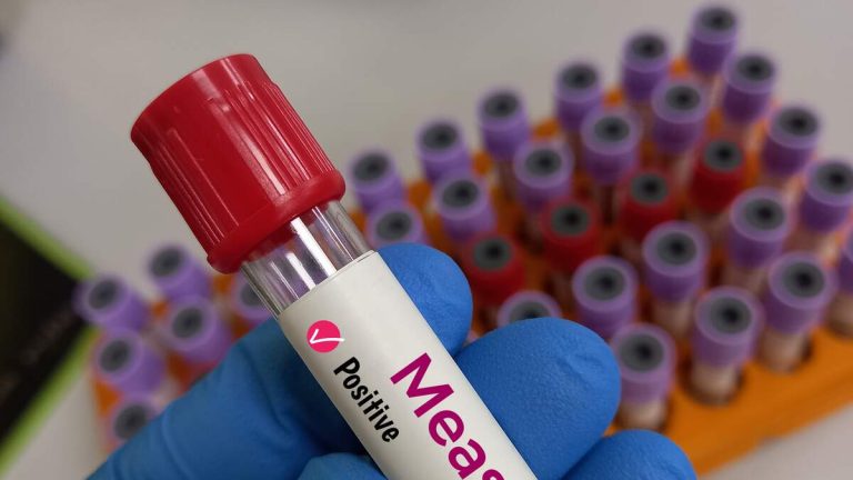 Measles Outbreak Reported In Nation’s Largest Immigrant Detention Facility