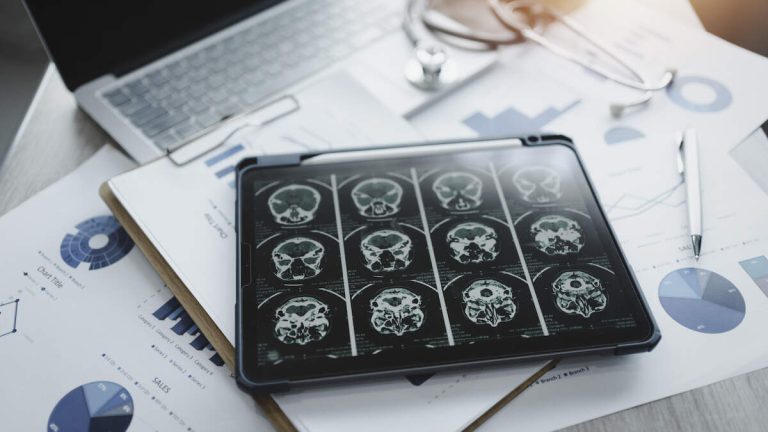 Personality Trait That Lowers Risk Of Dementia Revealed