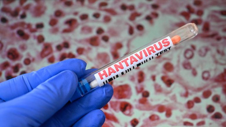 Possible Hantavirus Case Not Linked To Cruise Ship Reported In US