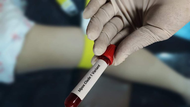 Scientists Accused Of Smuggling Contagious Pathogens From Africa Into US